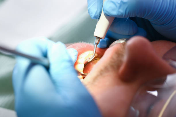 Best Tooth Infection Emergency Dentist  in Hanover Park, IL